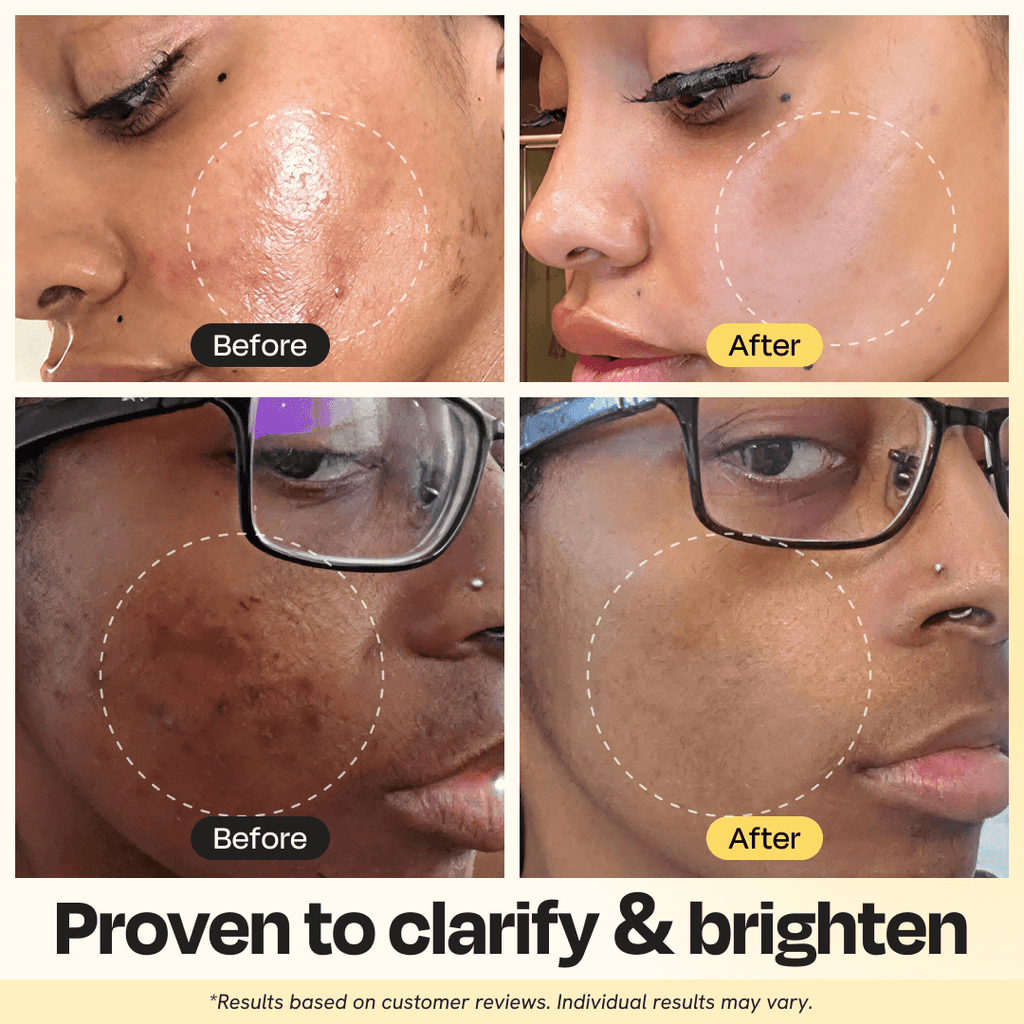 Vitamin C Clay Mask - MJ Trends