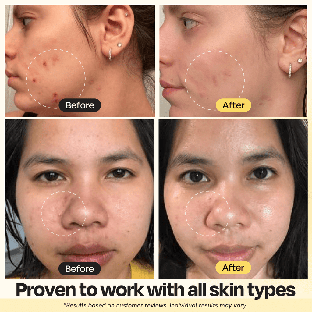 Vitamin C Clay Mask - MJ Trends